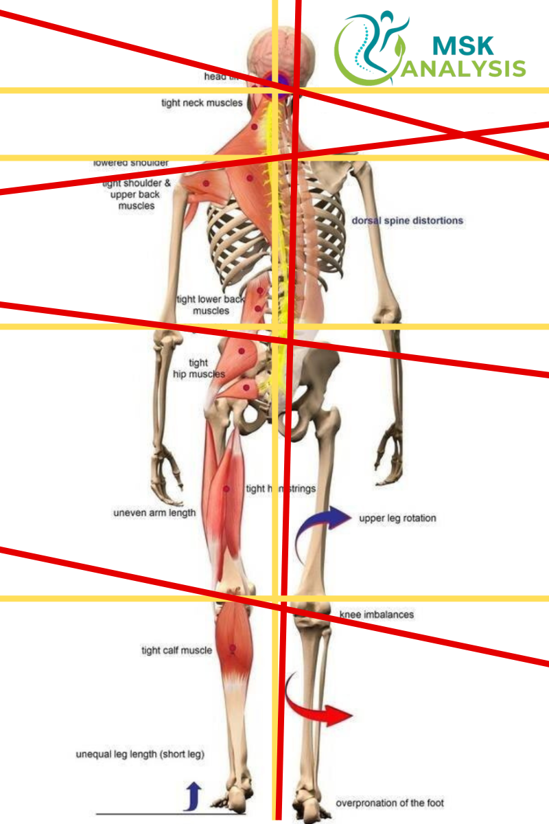 msk deviations