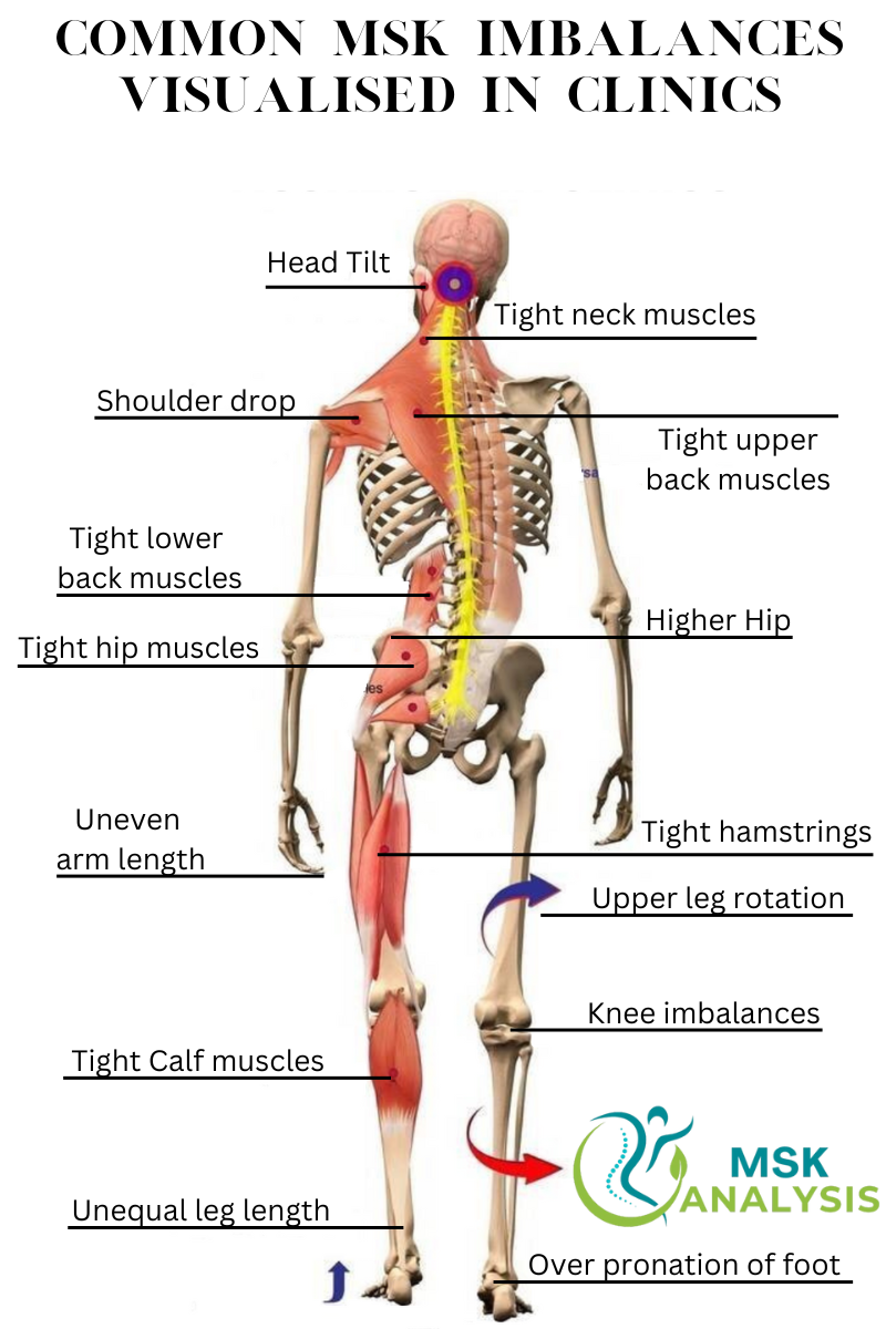 postural imbalances